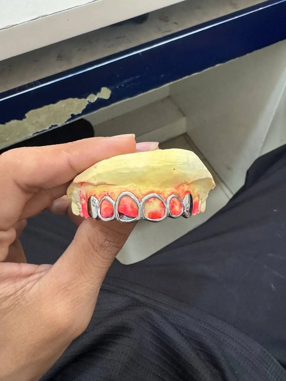 Full and window grillz in Phnom Penh Cambodia