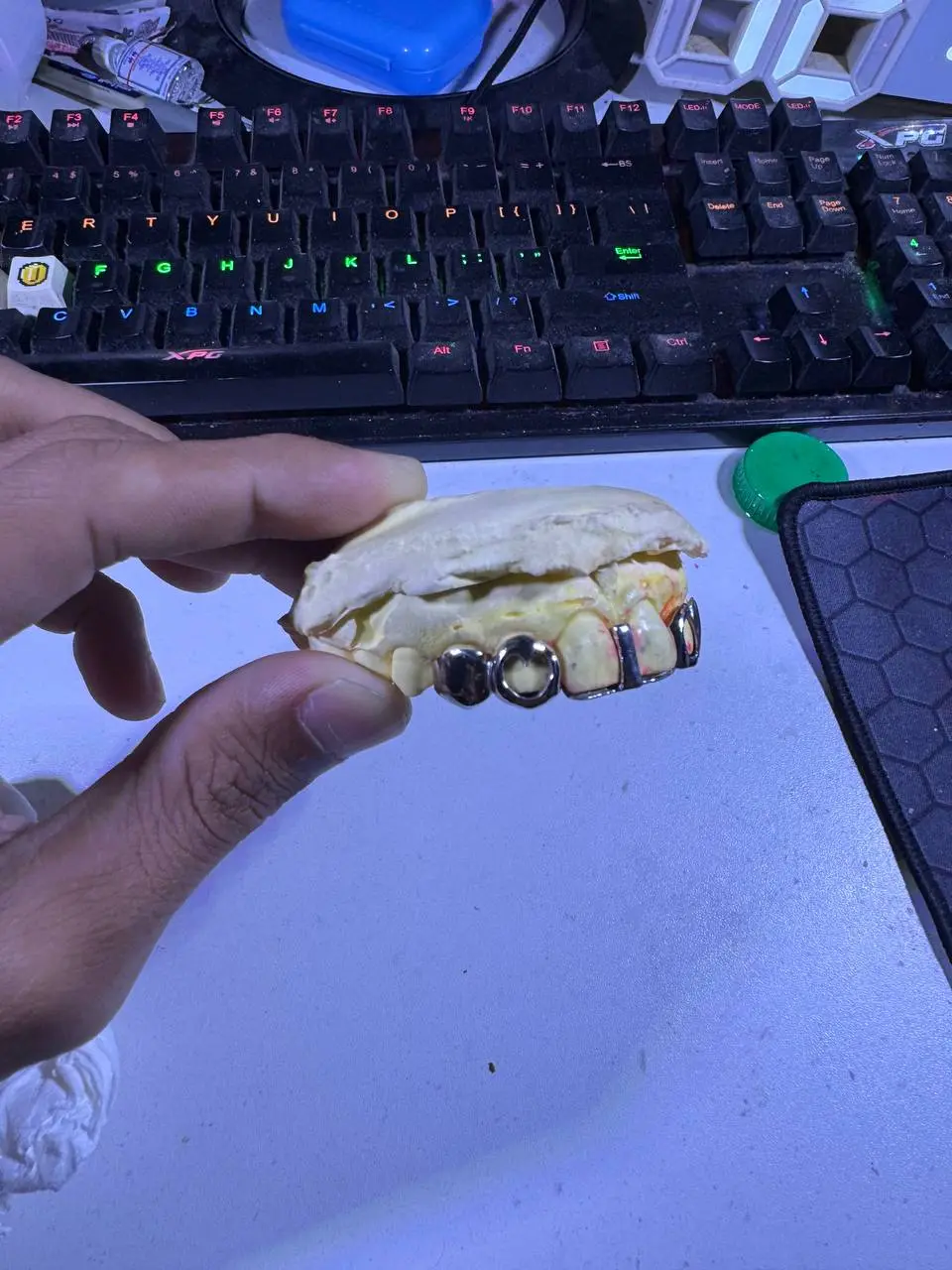 Custom Set grillz in Phnom Penh Cambodia