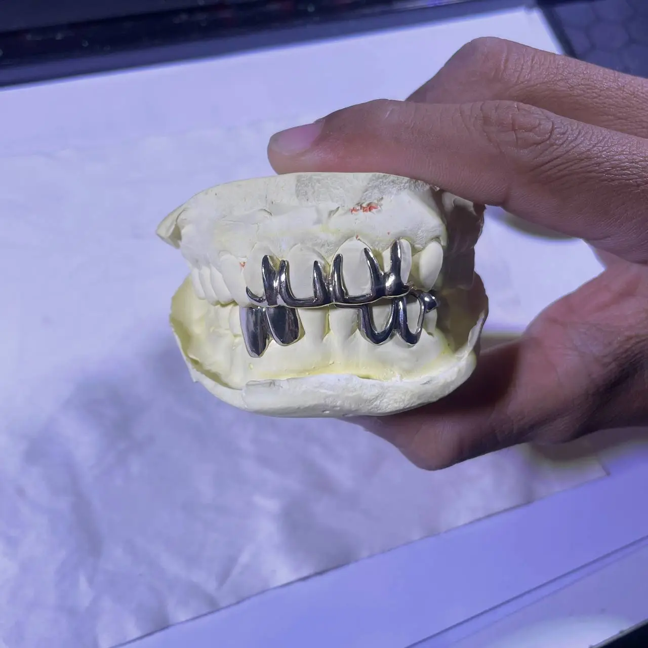 Custom set grillz in Phnom Penh Cambodia