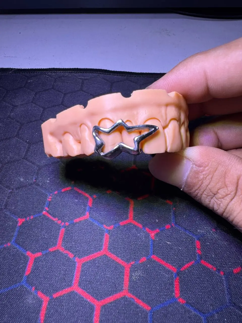 Star design grillz in Phnom Penh Cambodia