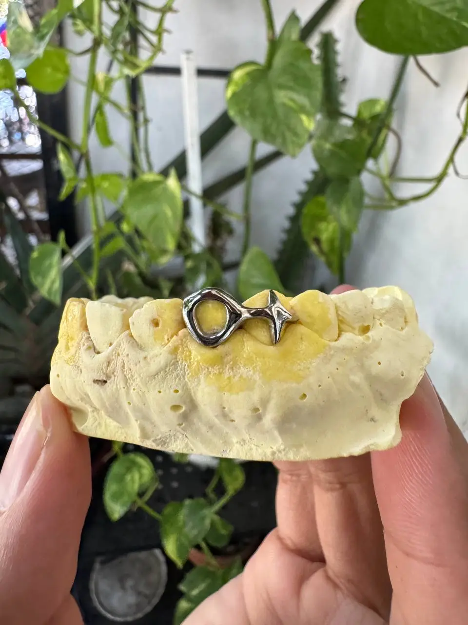 Detailed view of Window and star dental jewelry