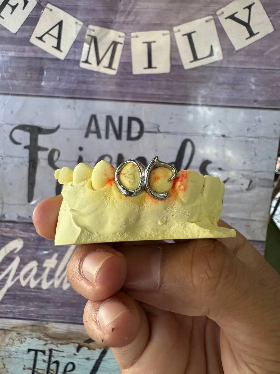 Window and custom style Grillz in Phnom Penh Cambodia